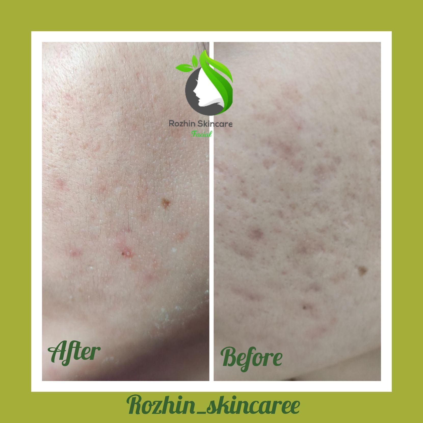 مرکز فیشیال روژین