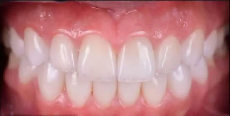 مطب دندانپزشکی درمان تخصصی ترمیمی و زیبایی پروتز وابت و متحرک