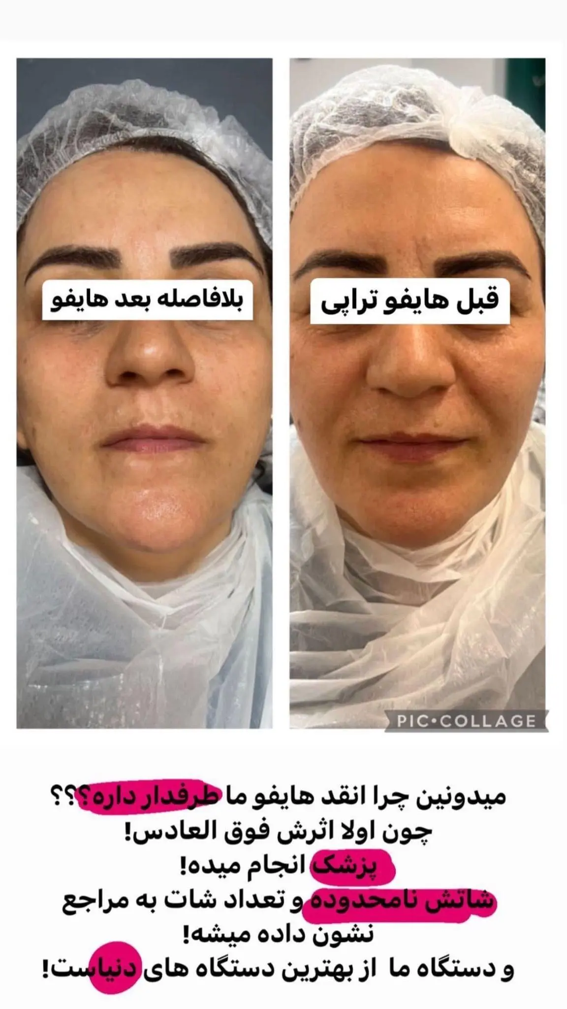 مطب زیبایی الن